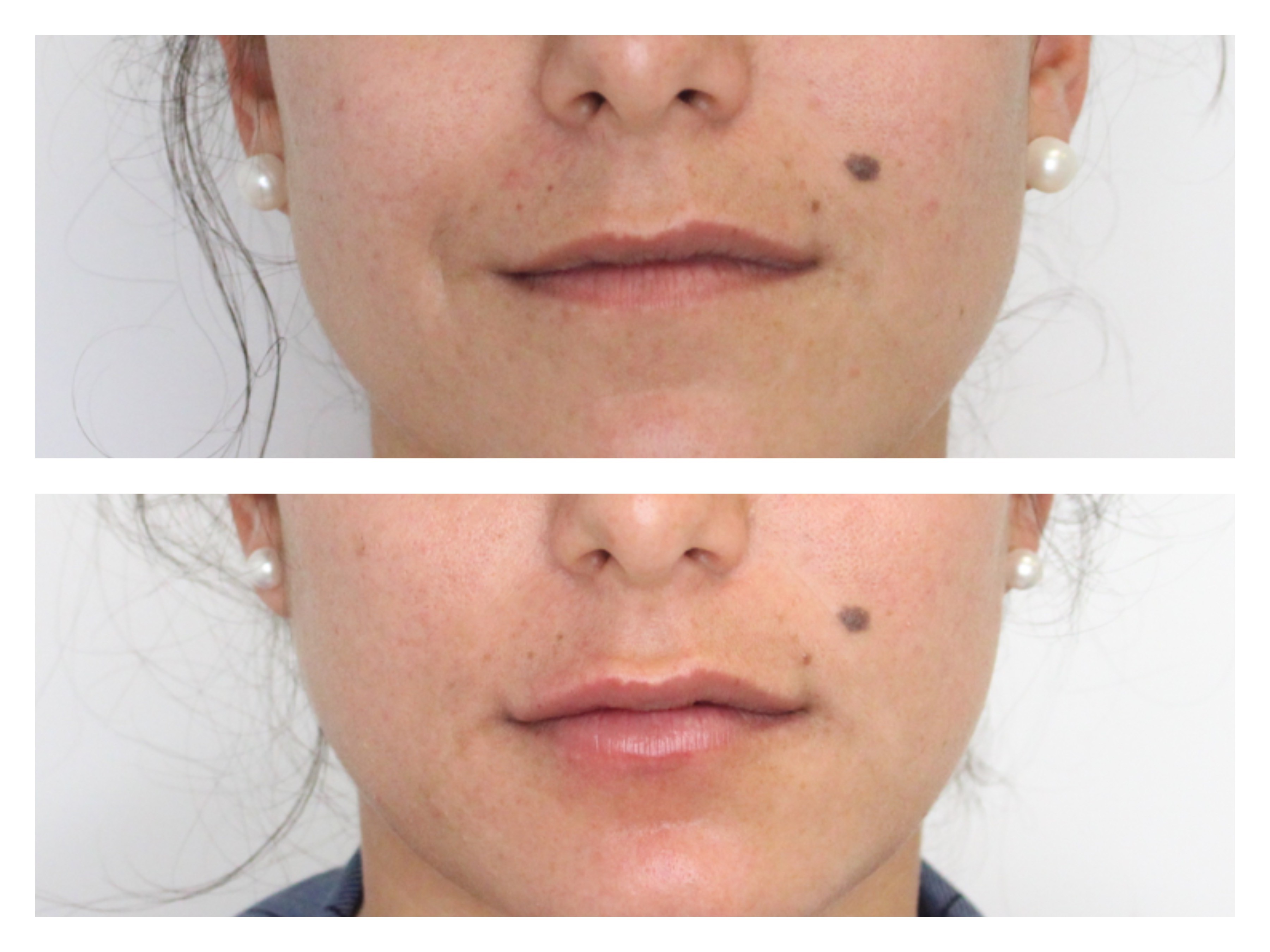 Aesthetics Clinic Geneva Gstaad Dr TENORIO