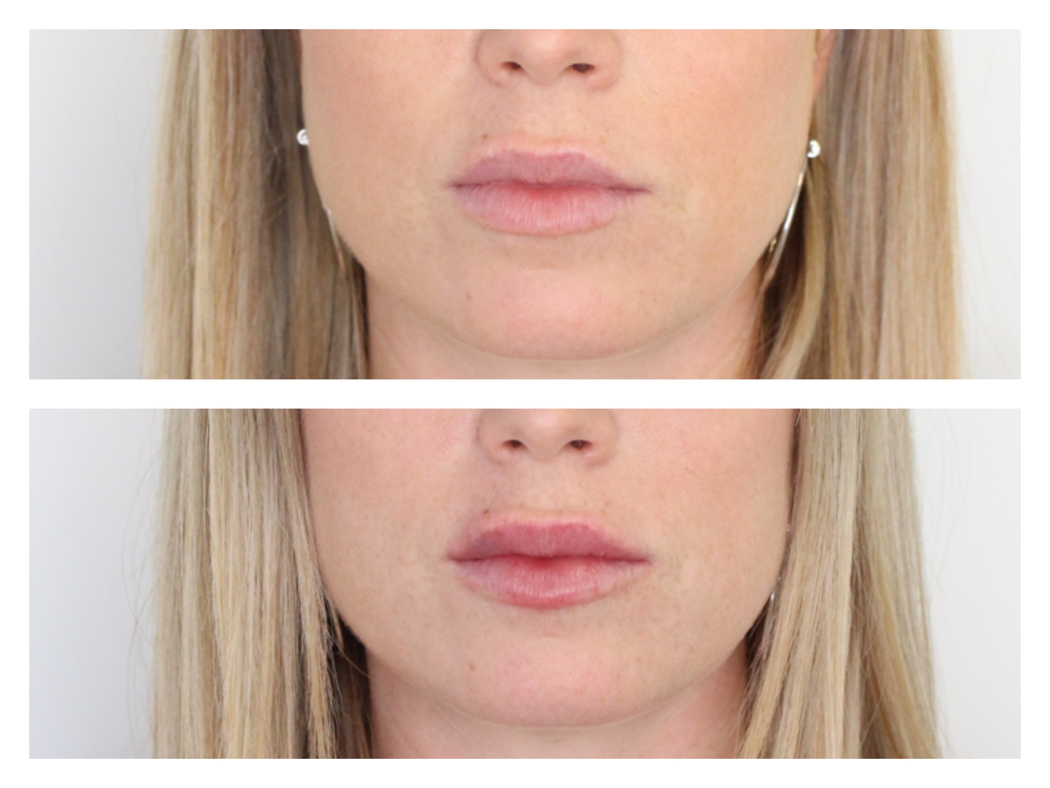 Aesthetics Clinic Geneva Gstaad Dr TENORIO